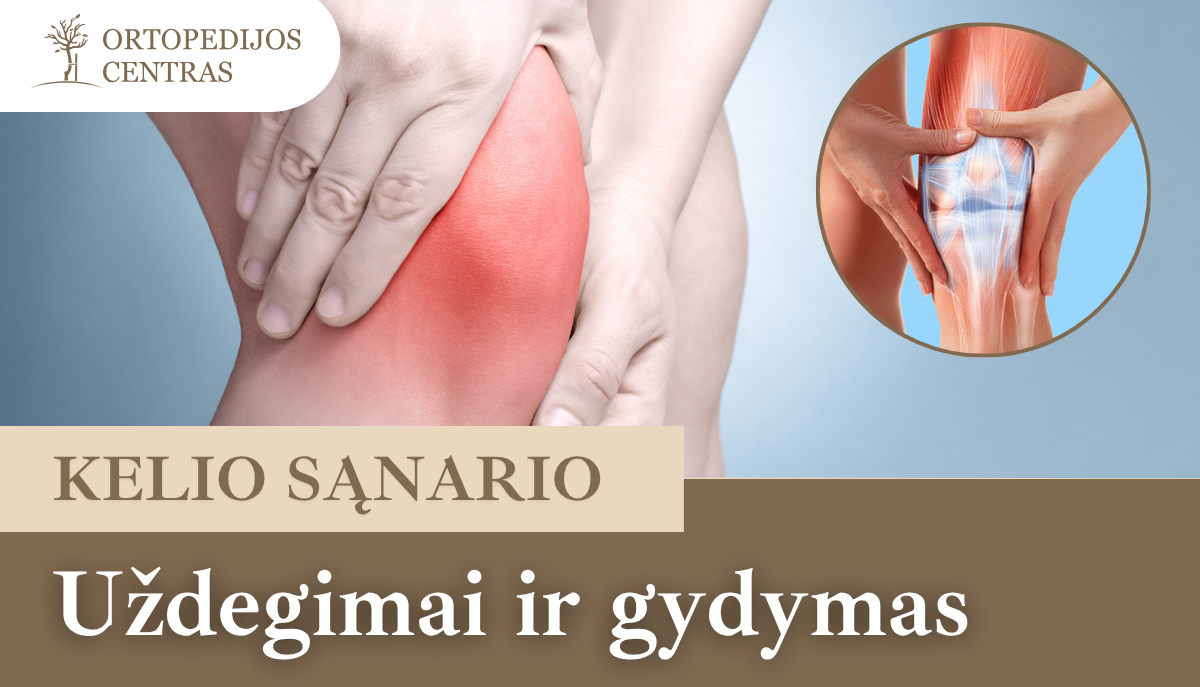 kelio-sanario-uzdegimai